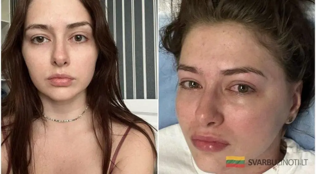 27-letnia aktorka walczy z tajemniczą chorobą. Ból głowy uniemożliwia normalne życie