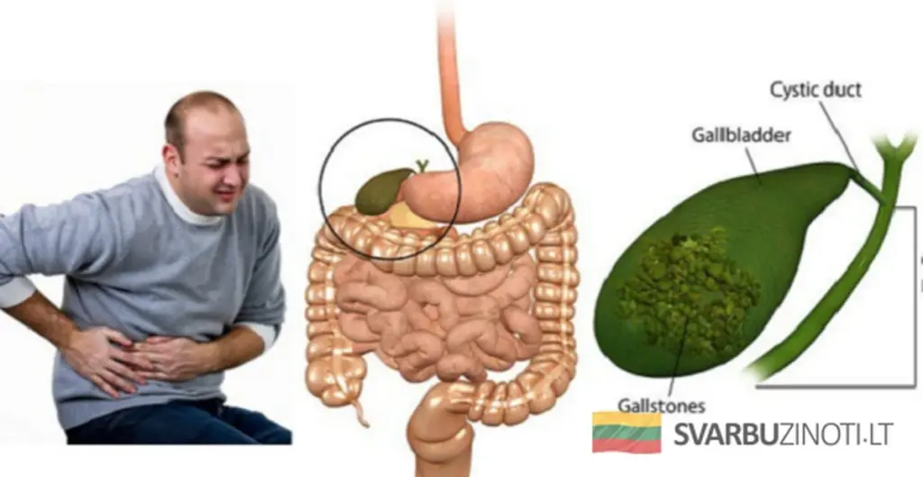 Chińska tajemnica: jak pozbyć się kamieni żółciowych w 7 dni