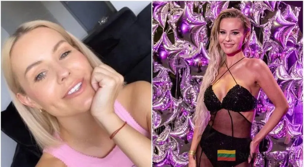 Indrė Burlinskaitė o chemioterapii: "Szokiem było dowiedzieć się, jak będę wyglądać"