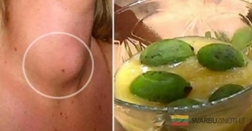 Jak wzmocnić tarczycę naturalnie: sekretny składnik, o którym lekarze milczą