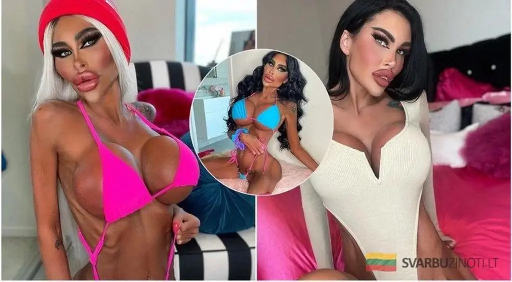 Od „królowej chirurgii plastycznej” do… Jak naprawdę wygląda kobieta uzależniona od operacji?