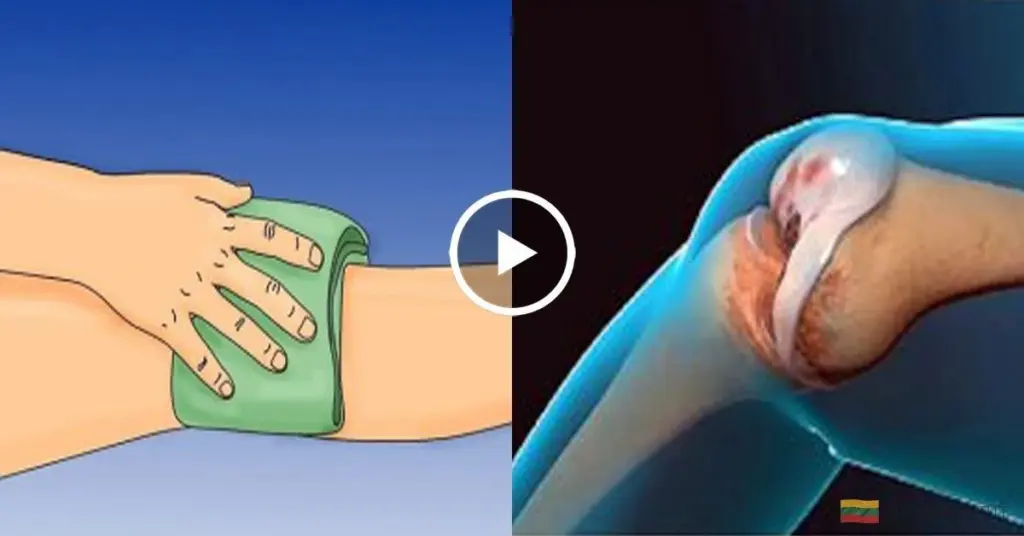 Okłady na kolana, które pokonają ból stawów – sprawdzone przepisy