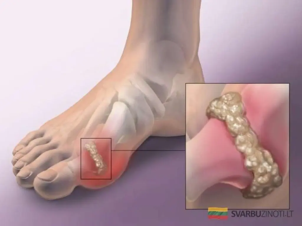 Sok z ogórka i selera: Twój sekret na pozbycie się kwasu moczowego