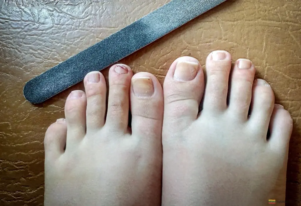 Domowy sposób na mocne paznokcie u stóp: Prosty przepis, który odmieni Twoje stopy