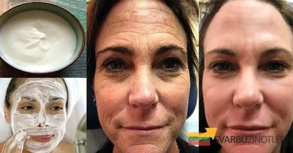 Turecka receptura na wygładzenie głębokich zmarszczek – probiotyczna maska z apteki!